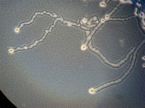  Xanthamoeba, mistrz kamuflażu w świecie mikroskopijnym!